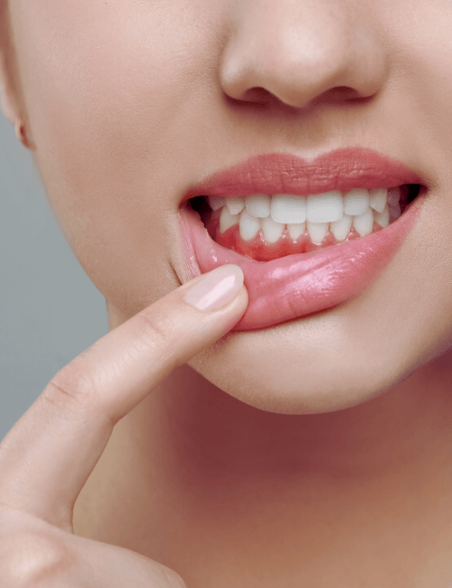 periodoncia en granada