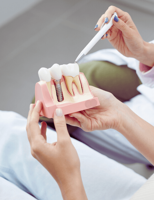 implantes dentales en granada