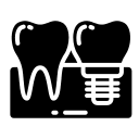 implantes y regeneracion osea