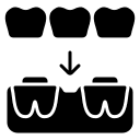 puente sobre implantes