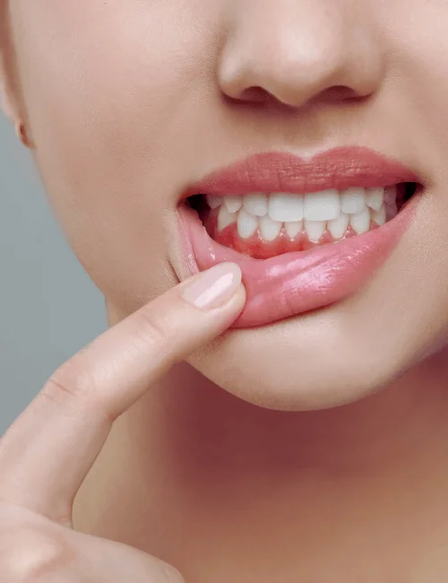 peridoncia en granada