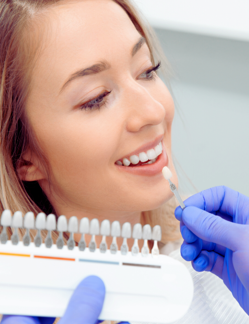 carillas dentales granada