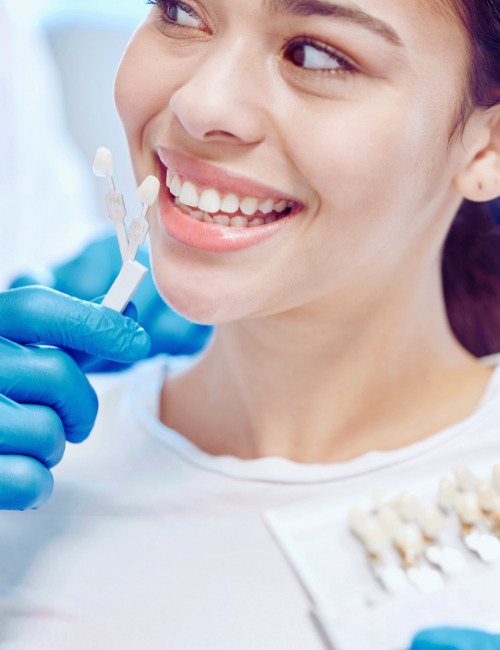 carillas dentales en granada