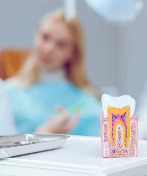 endodoncia en granada