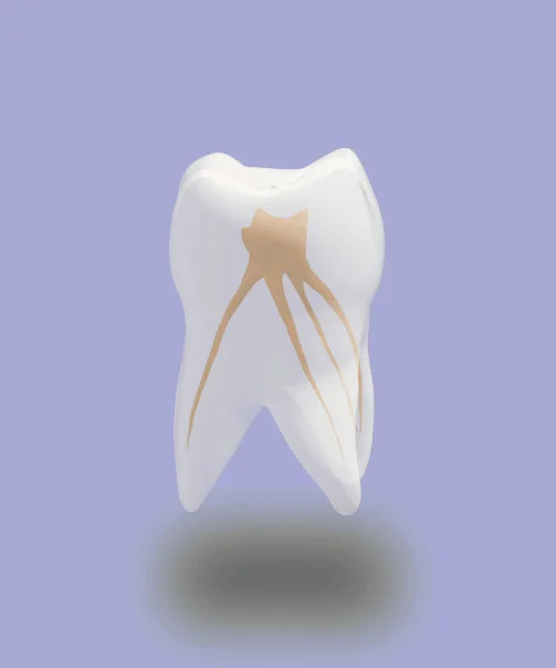 endodoncia granada